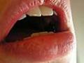 Causes of bad breath