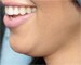 How to get rid of a double chin?