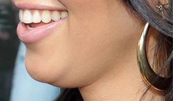 Tips to reduce double chin