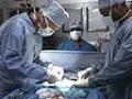 Liposuction: Benefits versus Risks