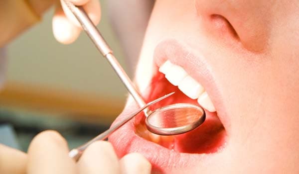 Tips on oral hygiene