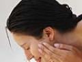 Preventing acne scars