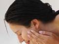 Preventing acne scars
