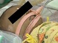 Video : There was cloth in her mouth, a pillow was on her face: Baby Afreen's mother
