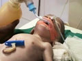 Video: Newborn thrown off third floor of building in Surat, survives