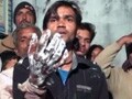 Video : 15 people dip hands in hot oil to prove loyalty