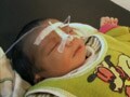 Video : Baby's intestines operated on 'by mistake'
