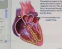 Video: 60% of Indians prone to heart disease