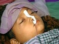 Video: Muzaffarpur mystery disease: Toll rises to 44