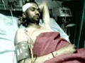 Video : Delhi blast: 7 days on, injured battle to live