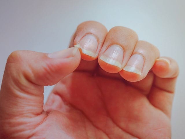 Photo : Nail Health: 5 Foods To Include In Your Diet For Healthy Nail Growth