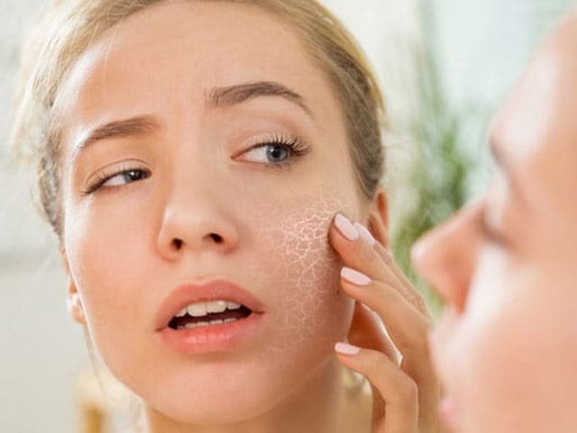 Photo : Winter Skincare: These 5 Foods Can Help To Keep To Your Skin Moisturized