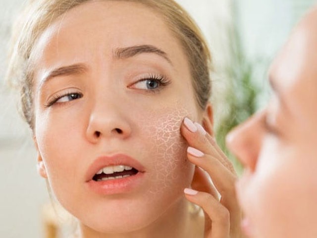Winter Skincare: These 5 Foods Can Help To Keep To Your Skin Moisturized