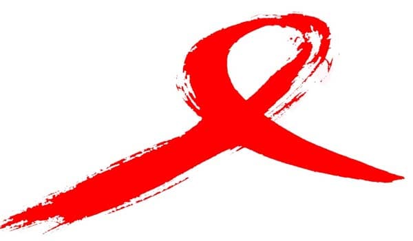 The symptoms of HIV are non-specific and commonly occur in a variety of conditions. To establish a diagnosis of HIV/AIDS a blood test that has been confirmed is essential. A physical examination and other tests are necessary to rule out other illnesses.