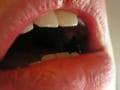 Photo : Causes of bad breath