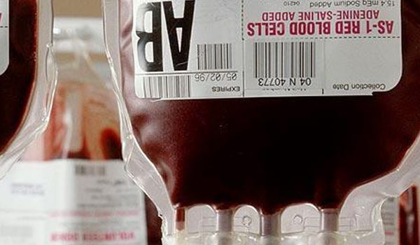 Donating blood will not leave you low of blood; in fact you will still have surplus blood after the donation.