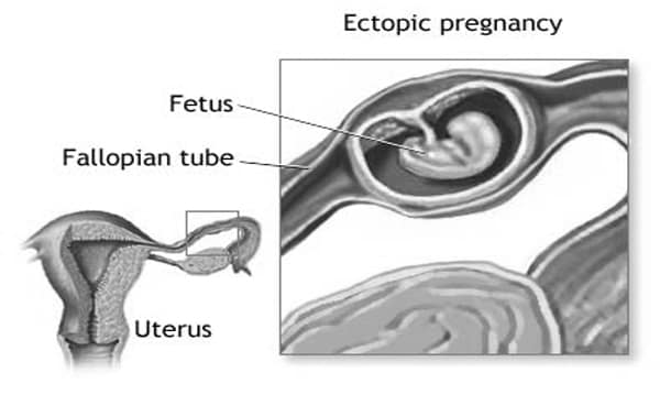 Uterus In Being Pregnant Features Function Size  Greater