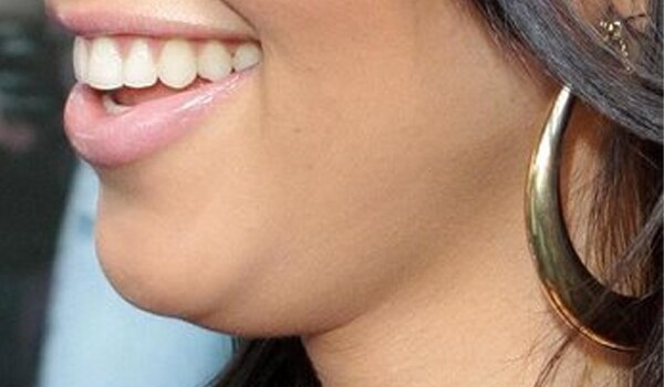 A double chin occurs when the musculus mylohyoideus - the muscle directly underneath the chin, slackens with age. This results in the impression of a second chin, which many people find unattractive and seek to eliminate. 
Certain vitamins, double chin exercises and neck massage can help treat a double chin.