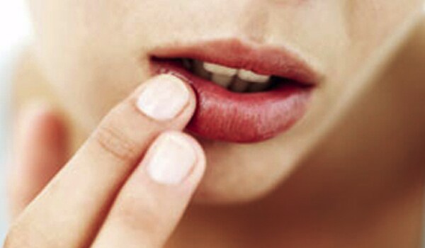Loss of moisture in the skin of the lips causes dry chapped lips. It happens due to exposure to sun, cold and dry weather, repeated licking, nutritional deficiency and hormonal imbalances.