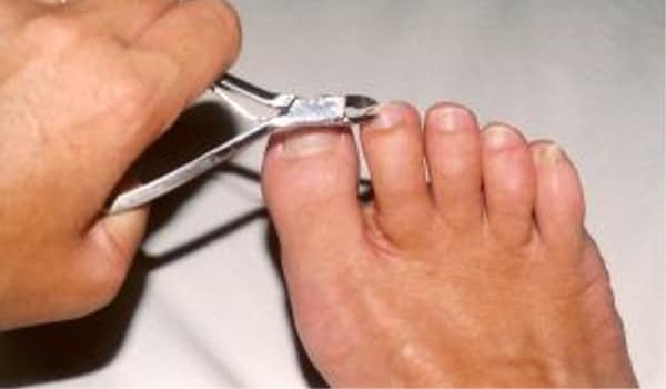 Cutting the nails of your feet regularly and cleaning the area between the nails and your toe prevents infections.