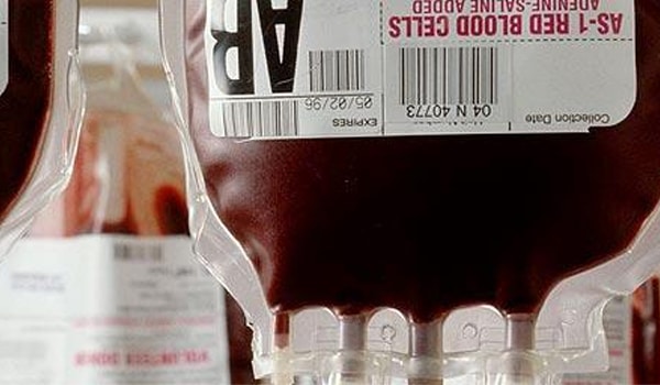 People who had blood transfusions or received blood products before 1985 also run at a high risk of HIV.