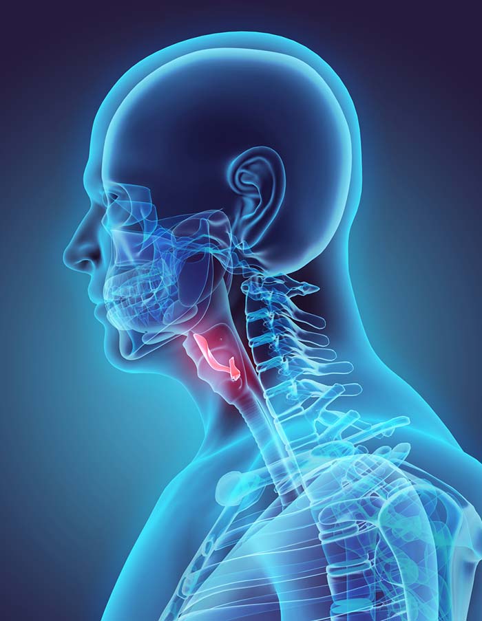 Hypothyroidism refers to a decrease in the function of the thyroid gland resulting in the production of low levels of thyroid hormones in the body. Hypothyroidism (or underactive thyroid gland) is a common thyroid gland disorder and is more prevalent in women.