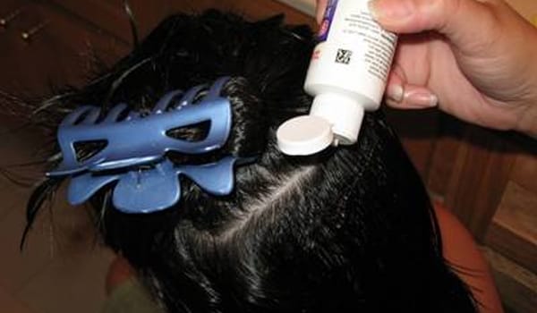 Medicated shampoos, creams, and lotions can end a lice infestation right away, but it may take about 5 days for the itching to stop.