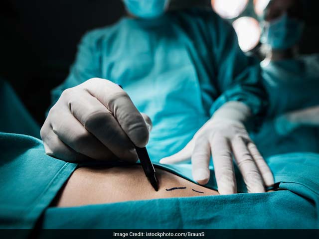 Liposuction: Benefits versus Risks