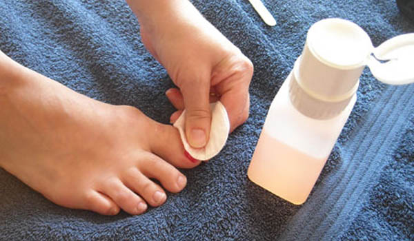 Never use an acetone-based or formaldehyde-based nail polish remover. Try to use or apply remover that has acetate in it.