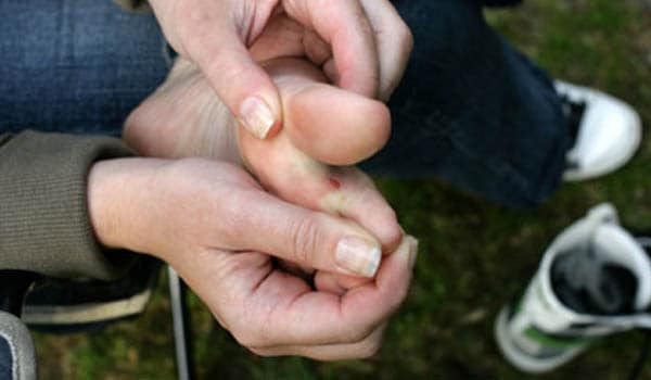Always keep two pairs of shoes and switch between them. This will help prevent fungal infections.