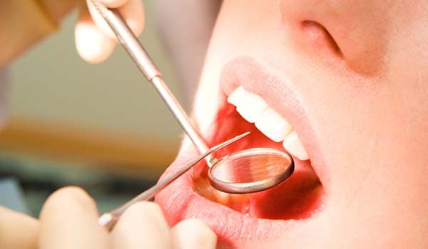 See your dentist regularly. Regular oral check ups help you avoid tooth loss, painful gums and other dental problems.