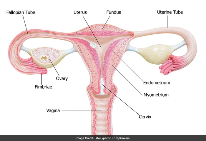 Some women with a tipped uterus experience pain during intercourse. The penis may hit the cervix or uterus during sex causing pain. This condition is known as collision dyspareunia.