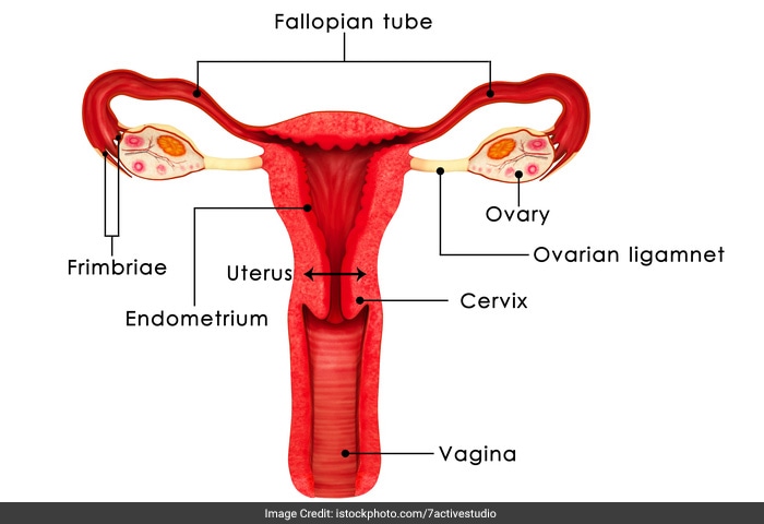 The endometrium, which is the tissue lining the uterus, may grow outside the uterus causing deep pain during sex.