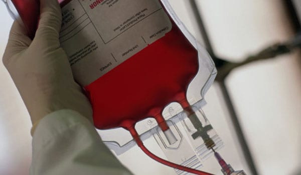 Blood transfusions are done to replace blood lost during surgery or due to a serious injury. In some cases, the infected virus may be transmitted through blood and blood products that you receive in blood transfusions.