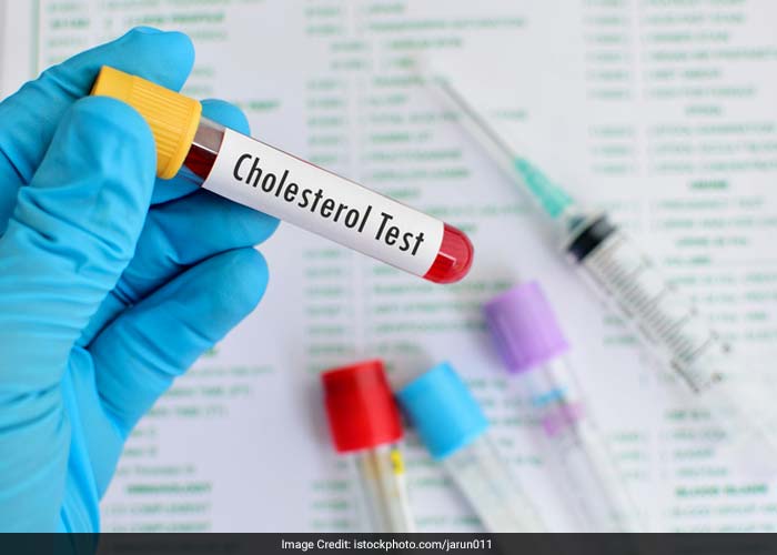 People with high blood cholesterol have a higher risk for stroke than others.  Also, it appears that low HDL (good) cholesterol is a risk factor for stroke in men, but more data are needed to verify its effect in women.