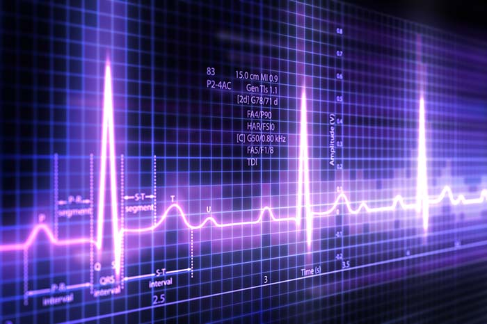 Electrocardiography (ECG) is useful in detecting a heart attack, angina, disorders of heart rhythm (arrhythmias) like heart block, fibrillation (very fast abnormal heart rhythm) or tachycardia (fast heart beat), etc. It is recommended that an ECG should be done for both men and women around age 50 years.