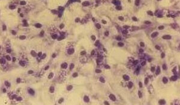 Preventing sexually transmitted infections