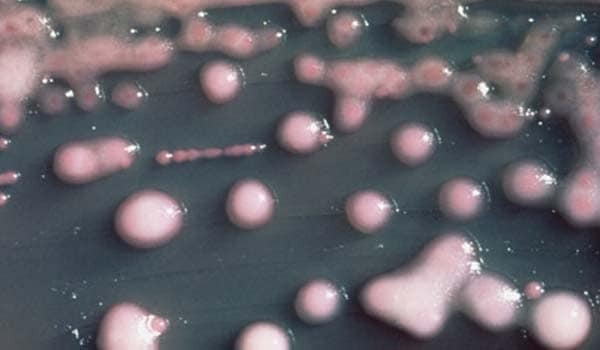 Signs of the bacteria were found in India, Bangladesh, Pakistan and the United Kingdom. It was most commonly found in a pneumonia strain and an <i>E. coli</i> strain.