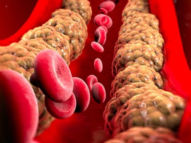सर्दियों में LDL Cholesterol को घटाने के लिए करें ये 6 काम