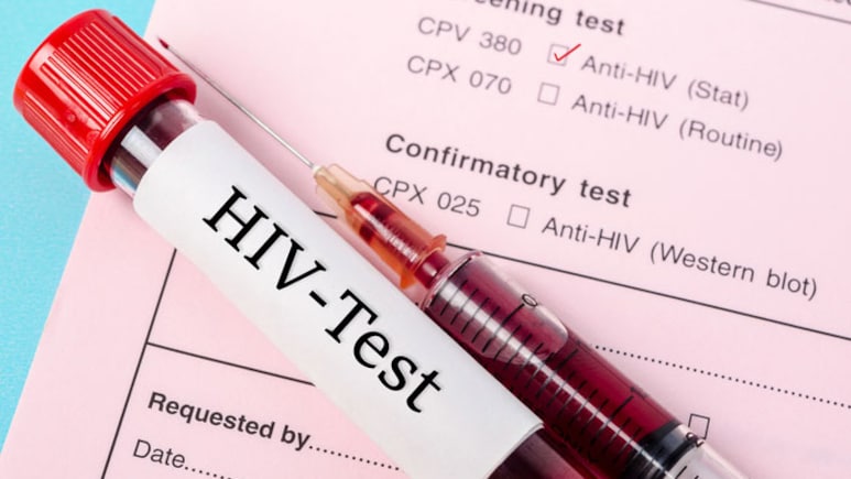 HIV Infection in Tripura: त्रिपुरा में बढ़े HIV इंफेक्शन के मामले, क्या है एचआईवी और कैसे फैलता है यह संक्रमण