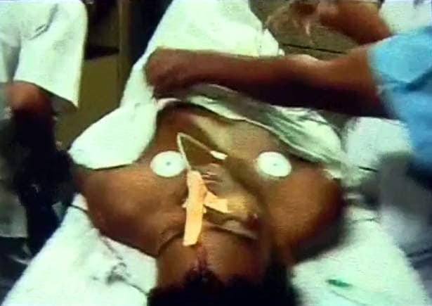 Ankesh was booked for rash and negligent driving but was released on bail within hours.<br><br>The motorcyclist is now in hospital with head and leg injuries.