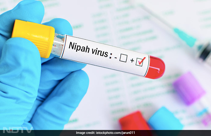 केरल में निपाह वायरस का मामला आया सामने, 43 साल के शख्स की र