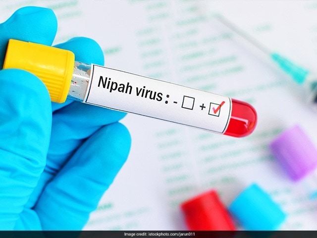 Photo : Nipah Virus: All You Need To Know About The Deadly Infection