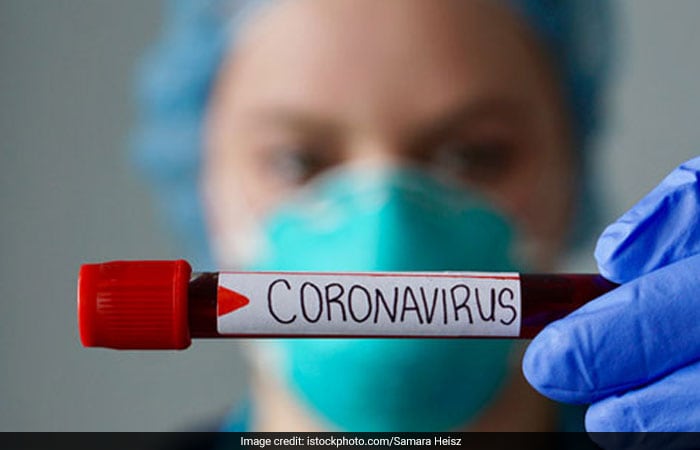 Coronavirus FAQs: Symptoms, Prevention And All You Need To Know About The New Pandemic COVID-19