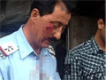 जम्मू-कश्मीर : मंत्री के सुरक्षा गार्डों ने ट्रैफिक पुलिसवाले को पीट डाला