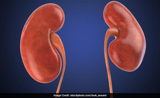What does an extrarenal pelvis signify?