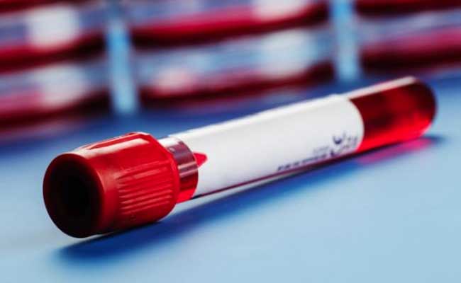 World Thalassemia Day 2017: All You Should Know About Thalassemia