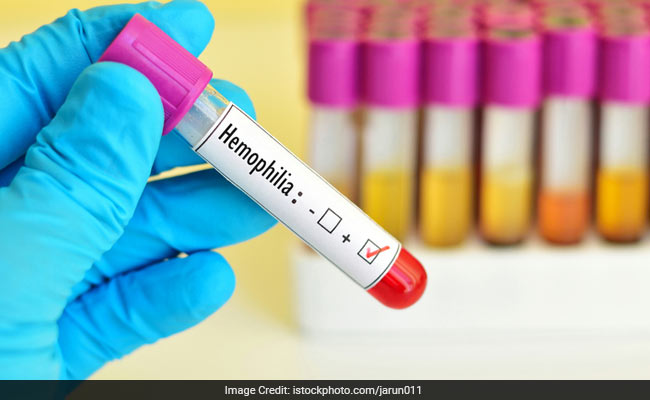 World Haemophilia Day 2017: Heres All You Should Know About This Bleeding Disorder