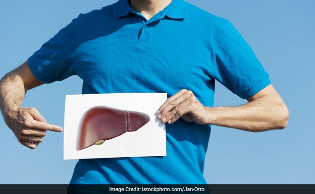 World Liver Day 2017: Know The Causes, Symptoms And Prevent Liver Diseases