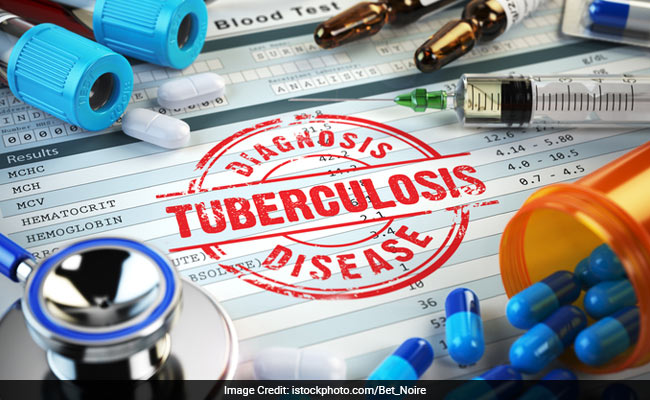 45% Rise In Number Of Tuberculosis Cases In Rajasthan